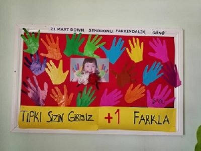 TIPKI SİZİN GİBİYİZ +1 FARKLA